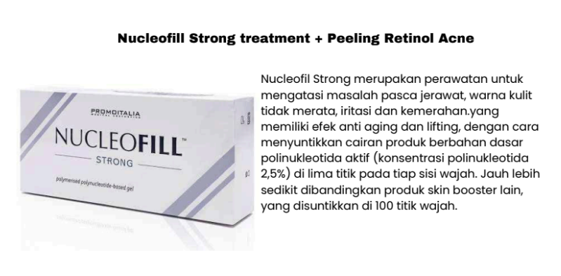 Profhil